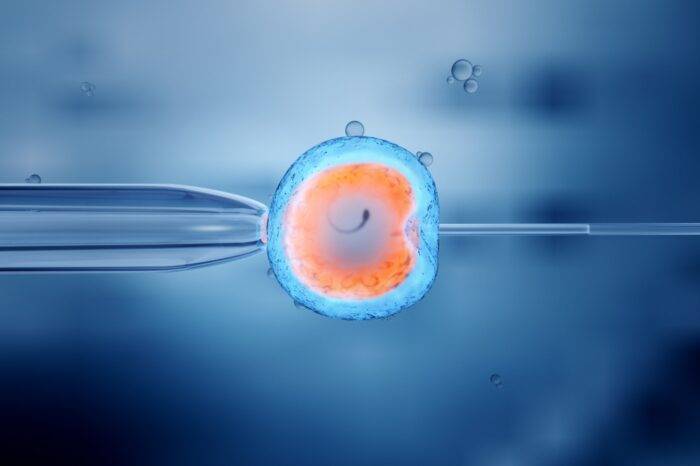 IVF (In Vitro Fertilization)